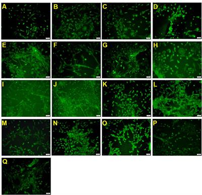 Promotion effect of the blend containing 2'-FL, OPN and DHA on oligodendrocyte progenitor cells myelination in vitro